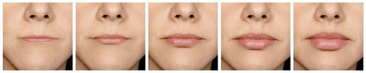 Lèvres – Face Lèvres – Face